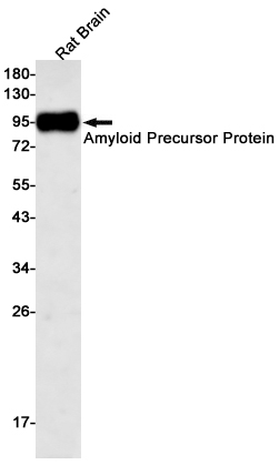 Amyloid Precursor Protein Rabbit mAb ABZ2668
