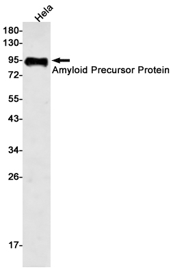 Amyloid Precursor Protein Rabbit mAb ABZ2669