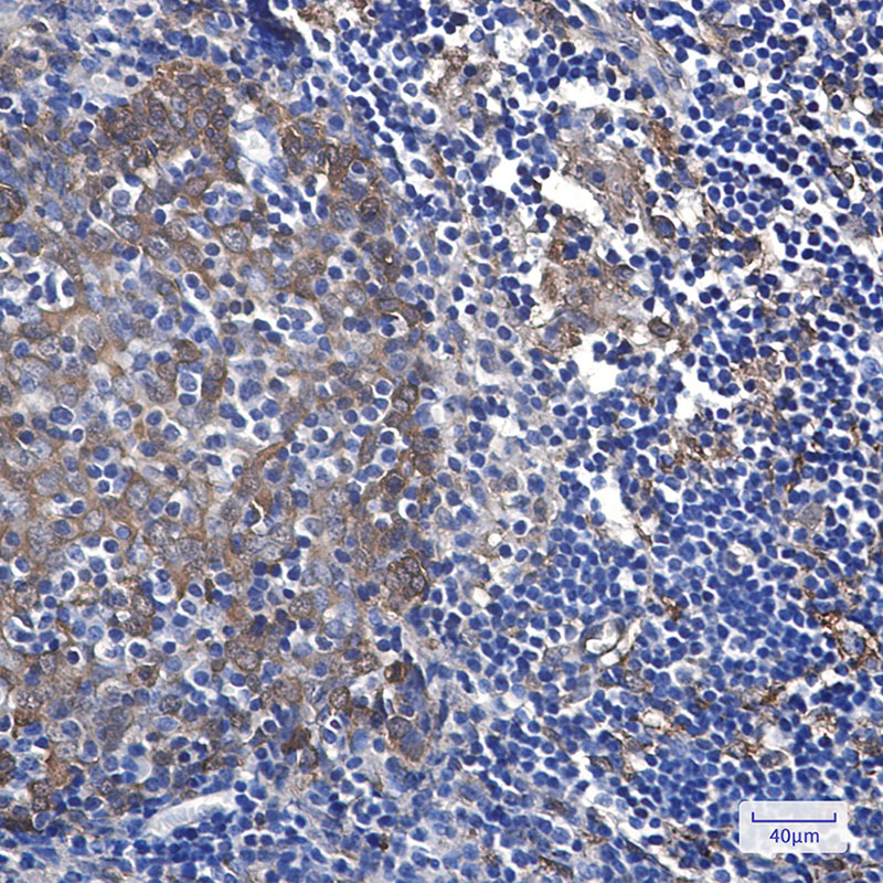 Hsp27 Rabbit mAb ABZ2670