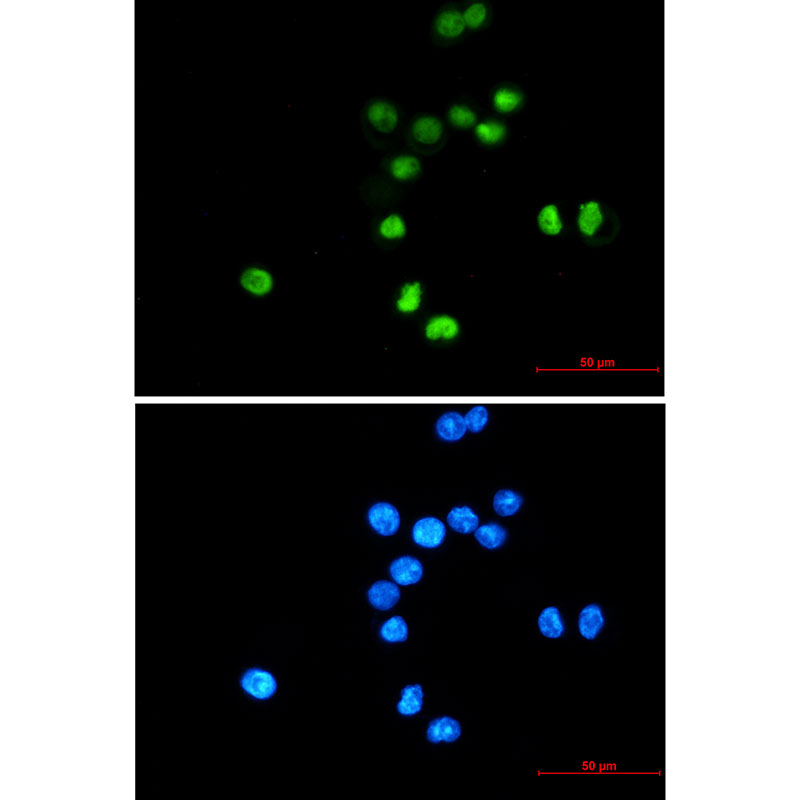 p53 Rabbit mAb ABZ2671