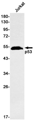 p53 Rabbit mAb ABZ2671