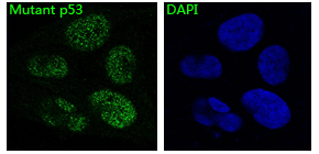 p53 Rabbit mAb ABZ2672