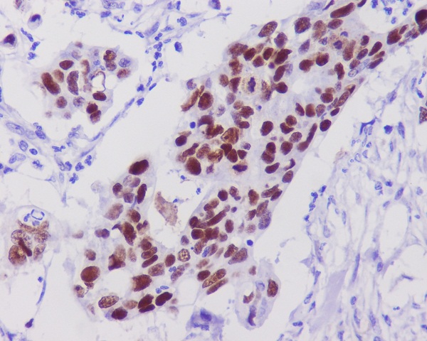 p53 Rabbit mAb ABZ2672