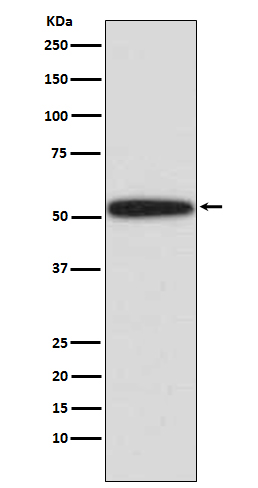 p53 Rabbit mAb ABZ2672
