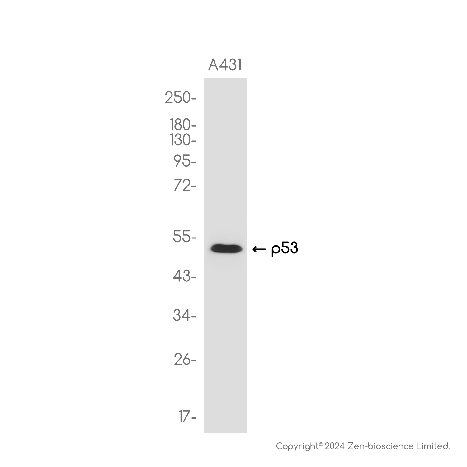 p53 Rabbit mAb ABZ2672