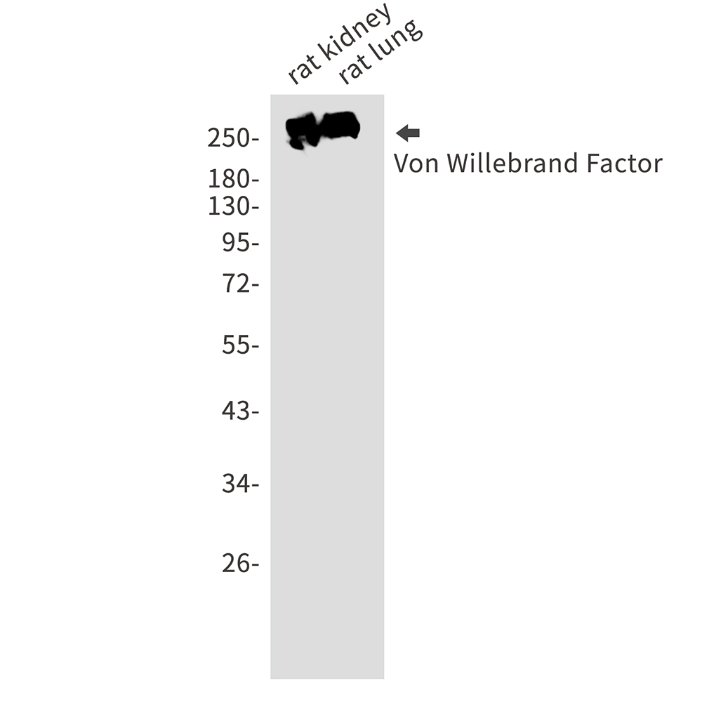 Von Willebrand Factor Rabbit mAb ABZ2673