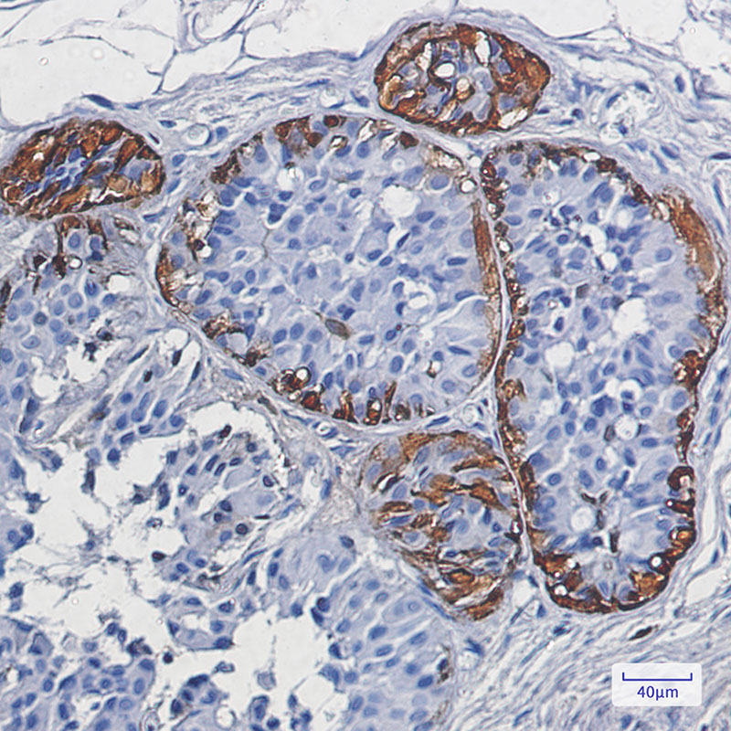 S100 beta Rabbit mAb ABZ2674