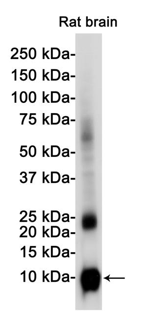 S100 beta Rabbit mAb ABZ2674