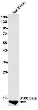 S100 beta Rabbit mAb ABZ2674