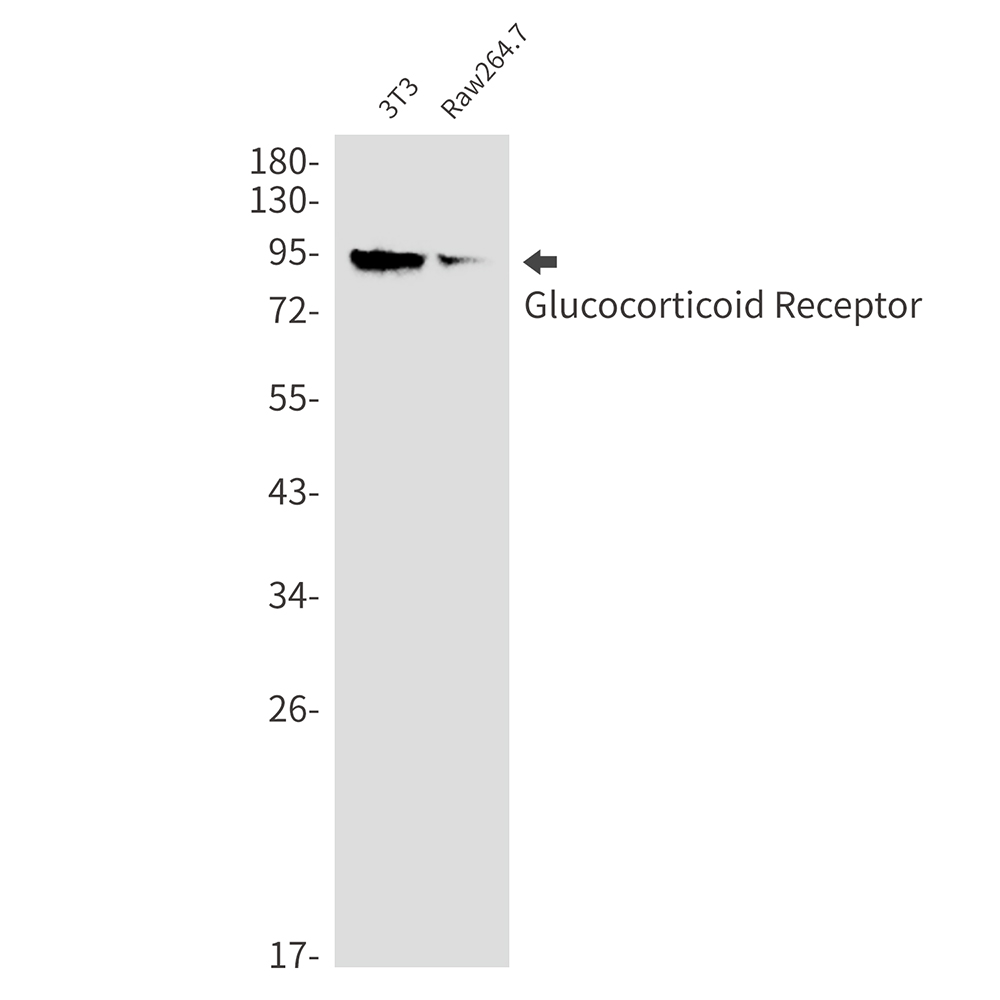 Glucocorticoid Receptor Rabbit mAb ABZ2676
