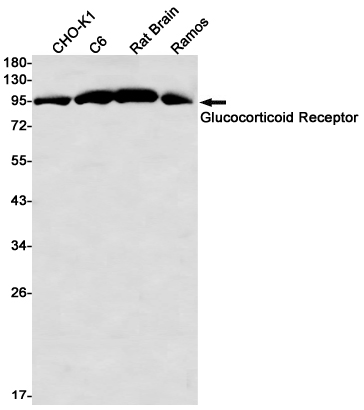 Glucocorticoid Receptor Rabbit mAb ABZ2676