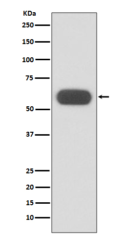 GBA Rabbit mAb ABZ2677