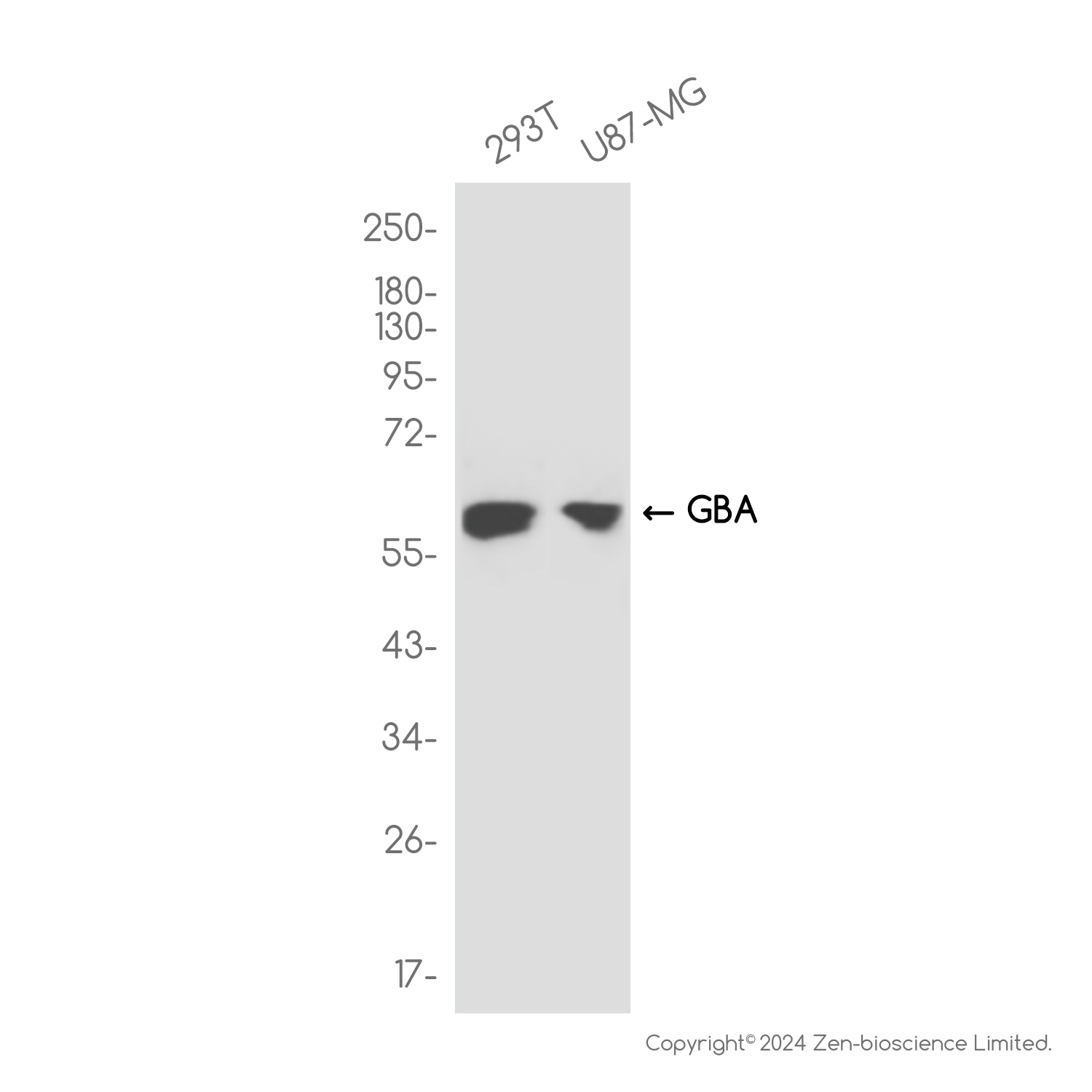 GBA Rabbit mAb ABZ2677