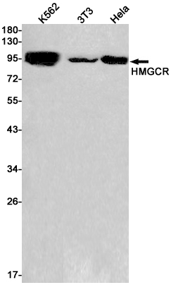 HMGCR Rabbit mAb ABZ2679