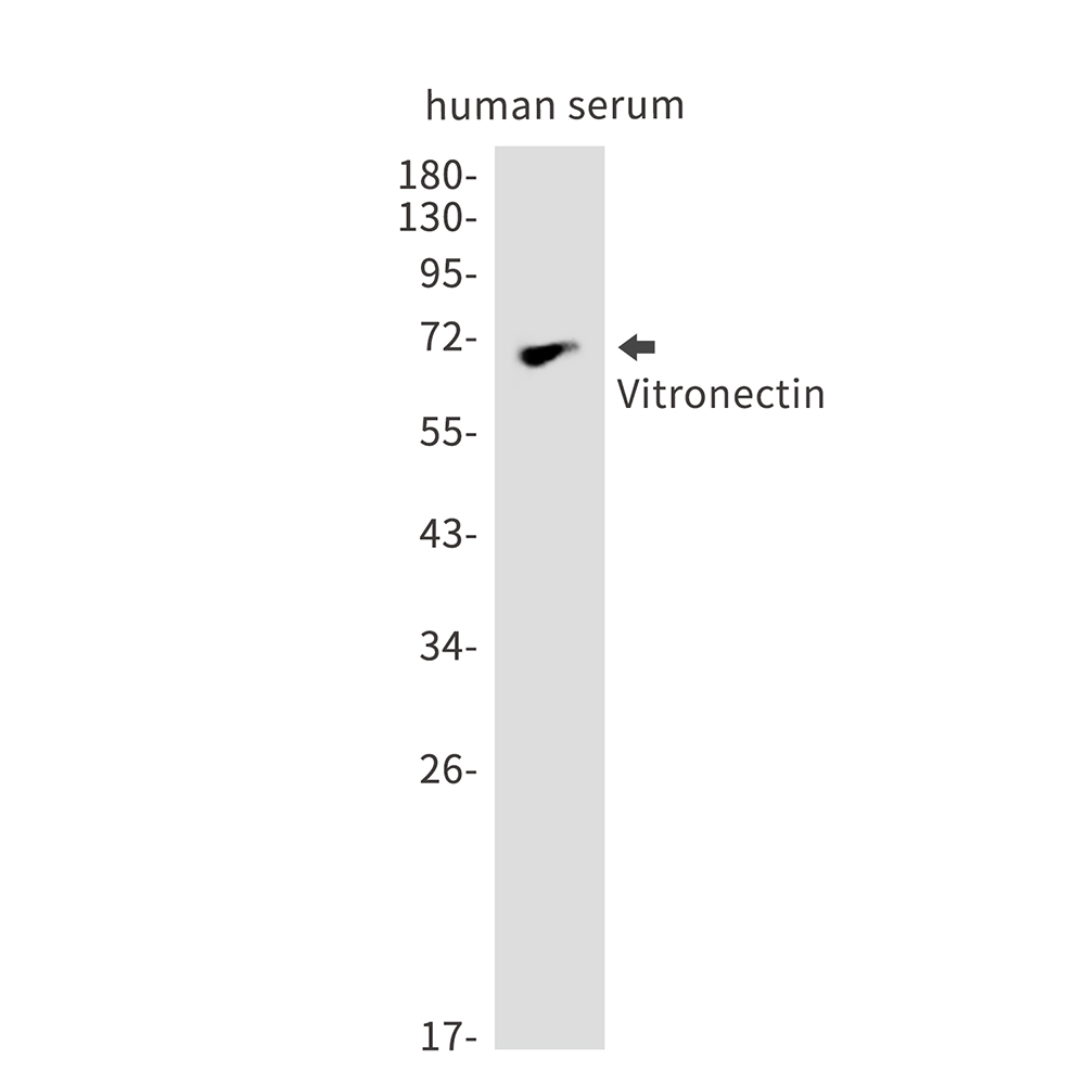 Vitronectin Rabbit mAb ABZ2680