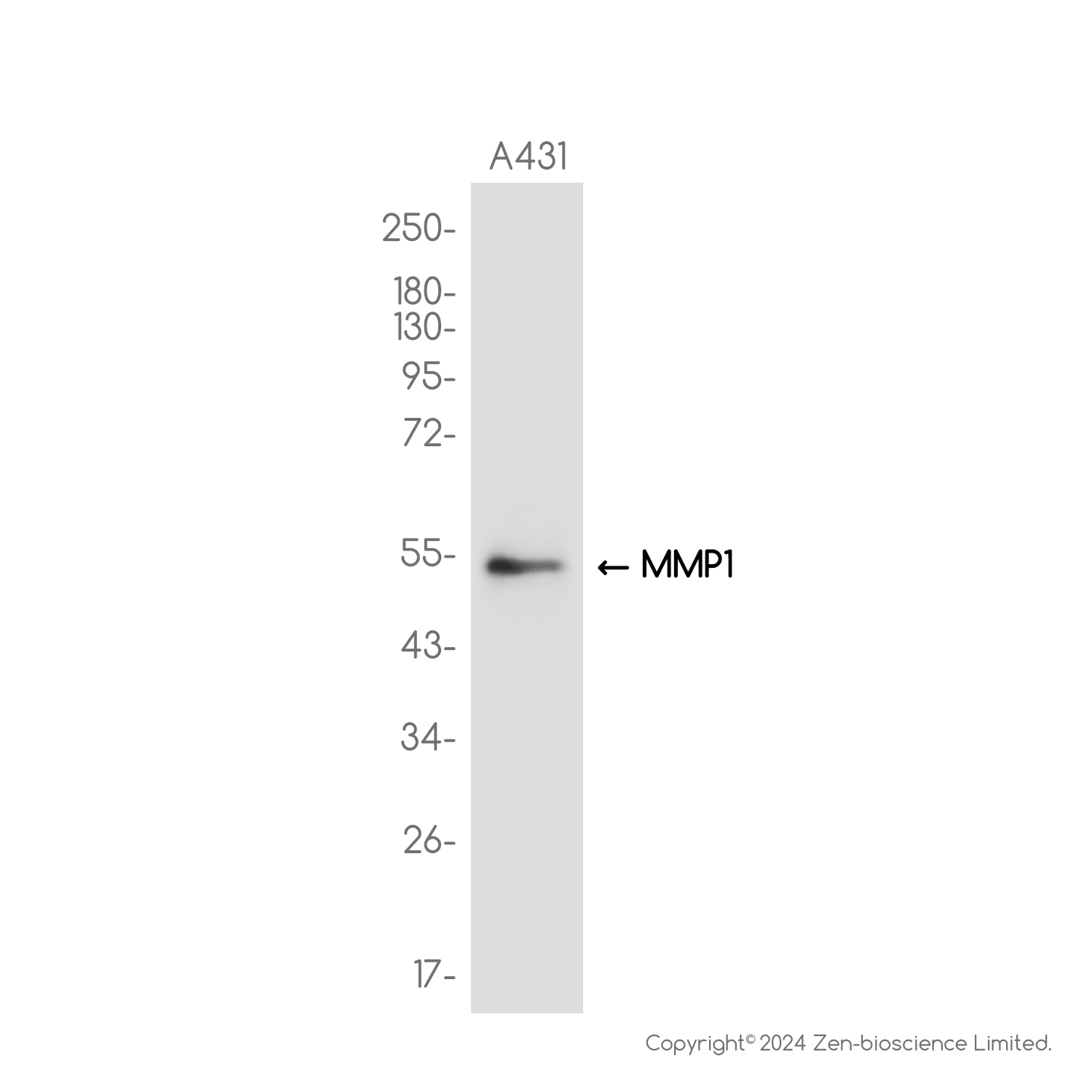 MMP1 Rabbit mAb ABZ2681