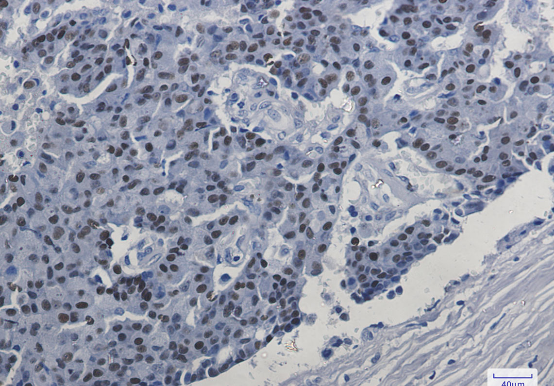 ER alpha Rabbit mAb ABZ2682