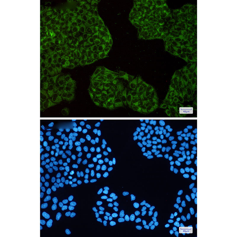 Ferritin Heavy Chain Rabbit mAb ABZ2683