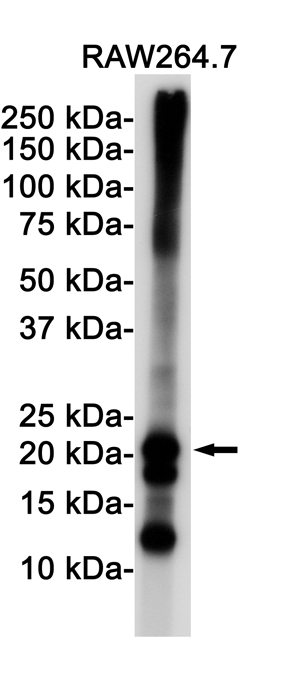 Ferritin Heavy Chain Rabbit mAb ABZ2683