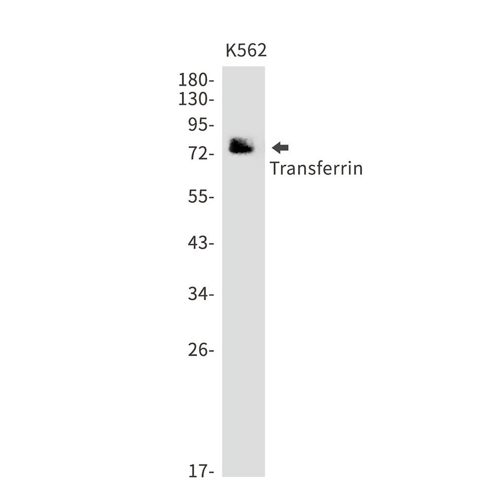 Transferrin Rabbit mAb ABZ2684