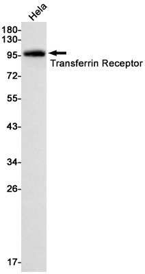 Transferrin Receptor Rabbit mAb ABZ2685