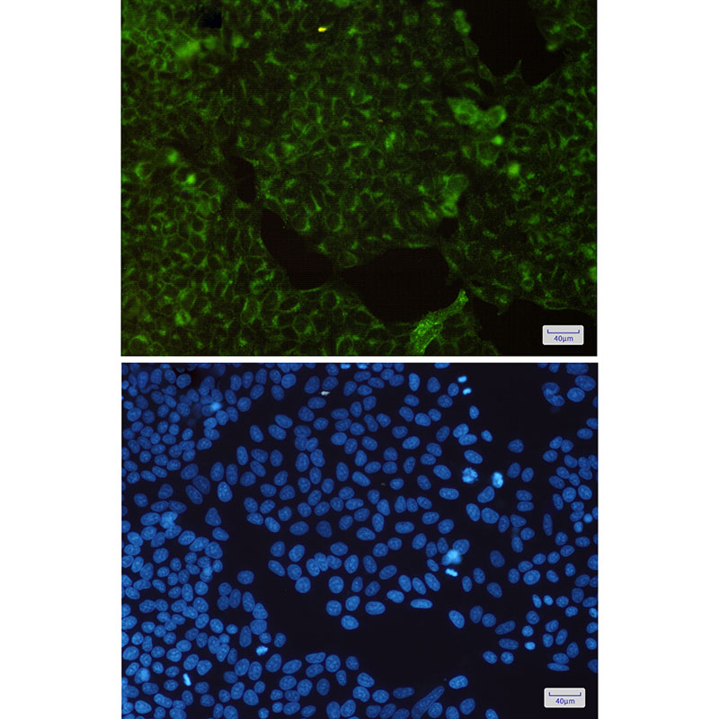 Transferrin Receptor Rabbit mAb ABZ2686