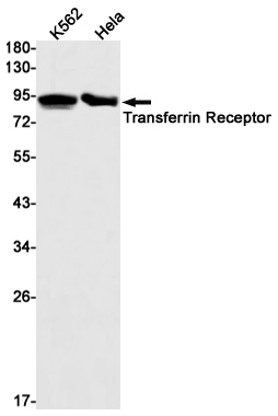 Transferrin Receptor Rabbit mAb ABZ2686