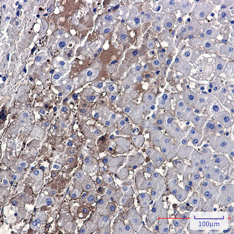 PF4 Rabbit mAb ABZ2687