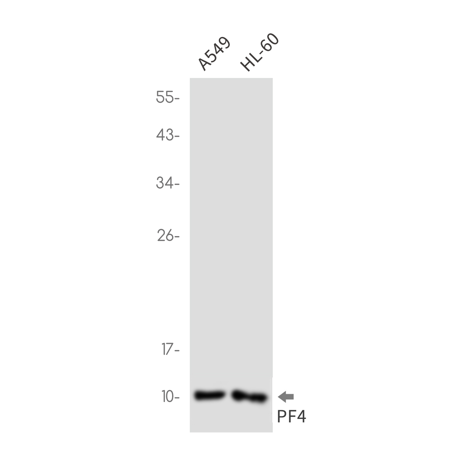 PF4 Rabbit mAb ABZ2687