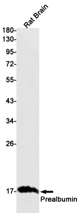 Prealbumin Rabbit mAb ABZ2688