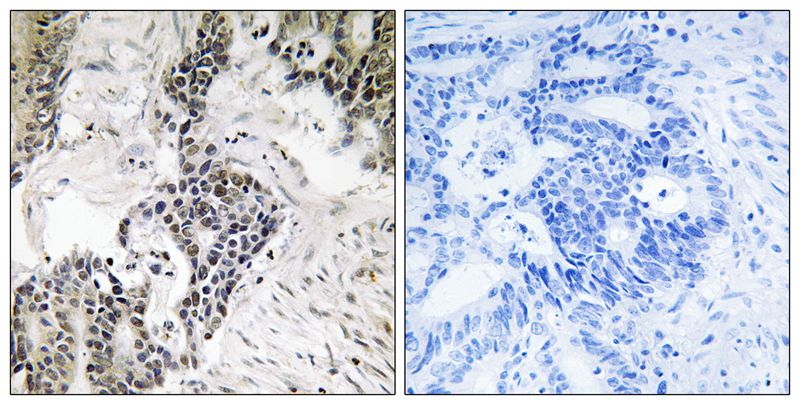 Phospho-CDC25C (Ser198) Rabbit pAb ABZ2692