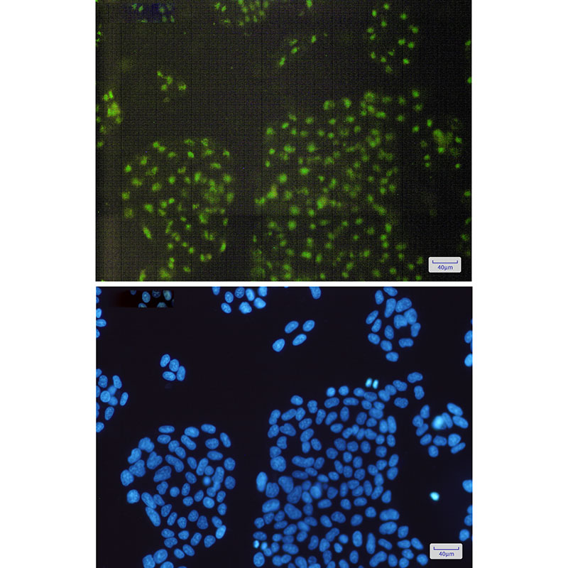 Alpha B Crystallin Rabbit mAb ABZ2693