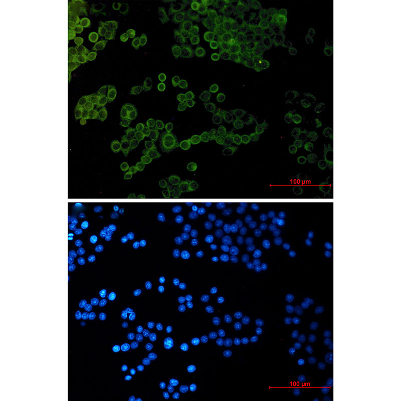 Collagen I alpha 1 Rabbit mAb ABZ2694