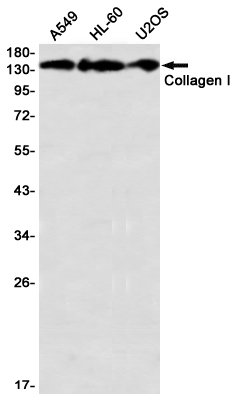 Collagen I alpha 1 Rabbit mAb ABZ2694