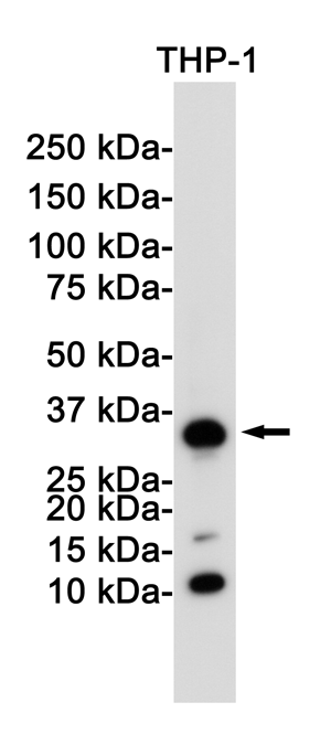 CD8 alpha Rabbit mAb ABZ2695