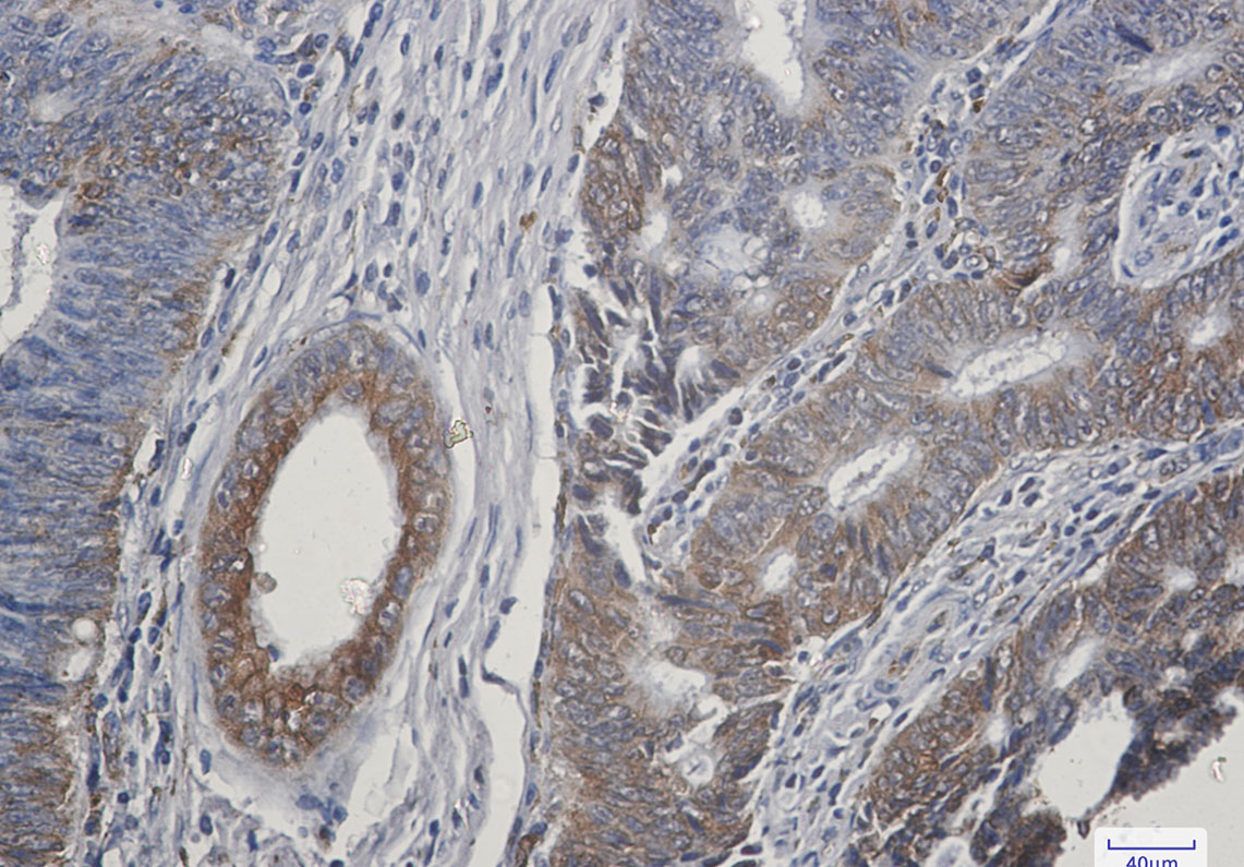 TGF alpha Rabbit mAb ABZ2696