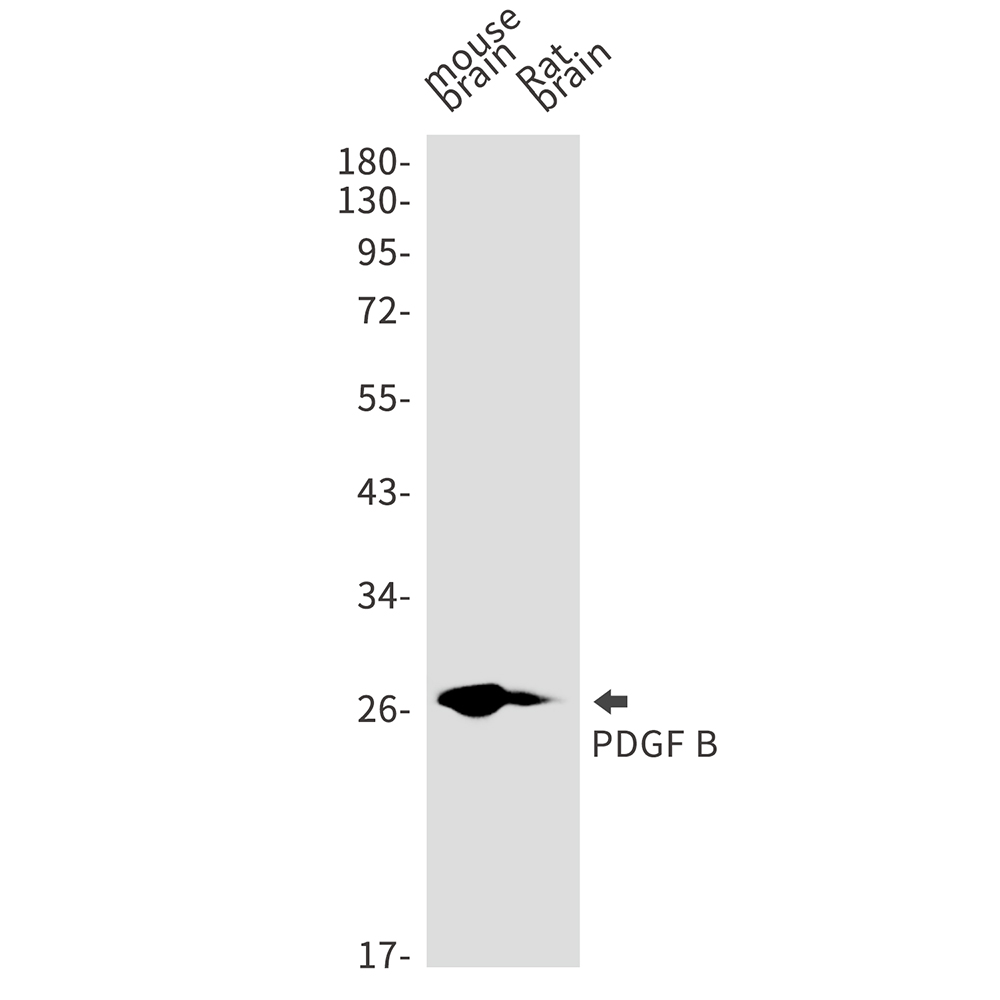 PDGF B Rabbit mAb ABZ2697