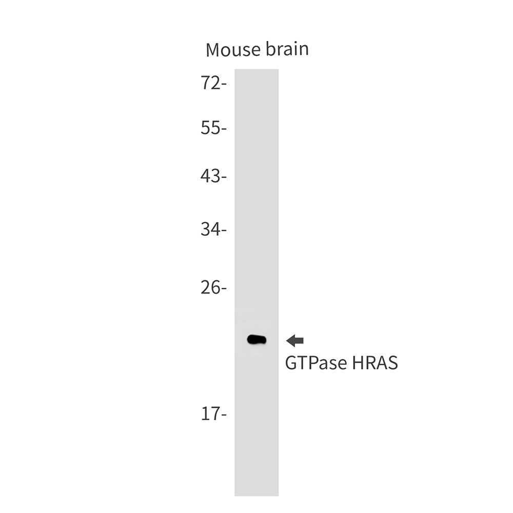 GTPase HRAS Rabbit mAb ABZ2699