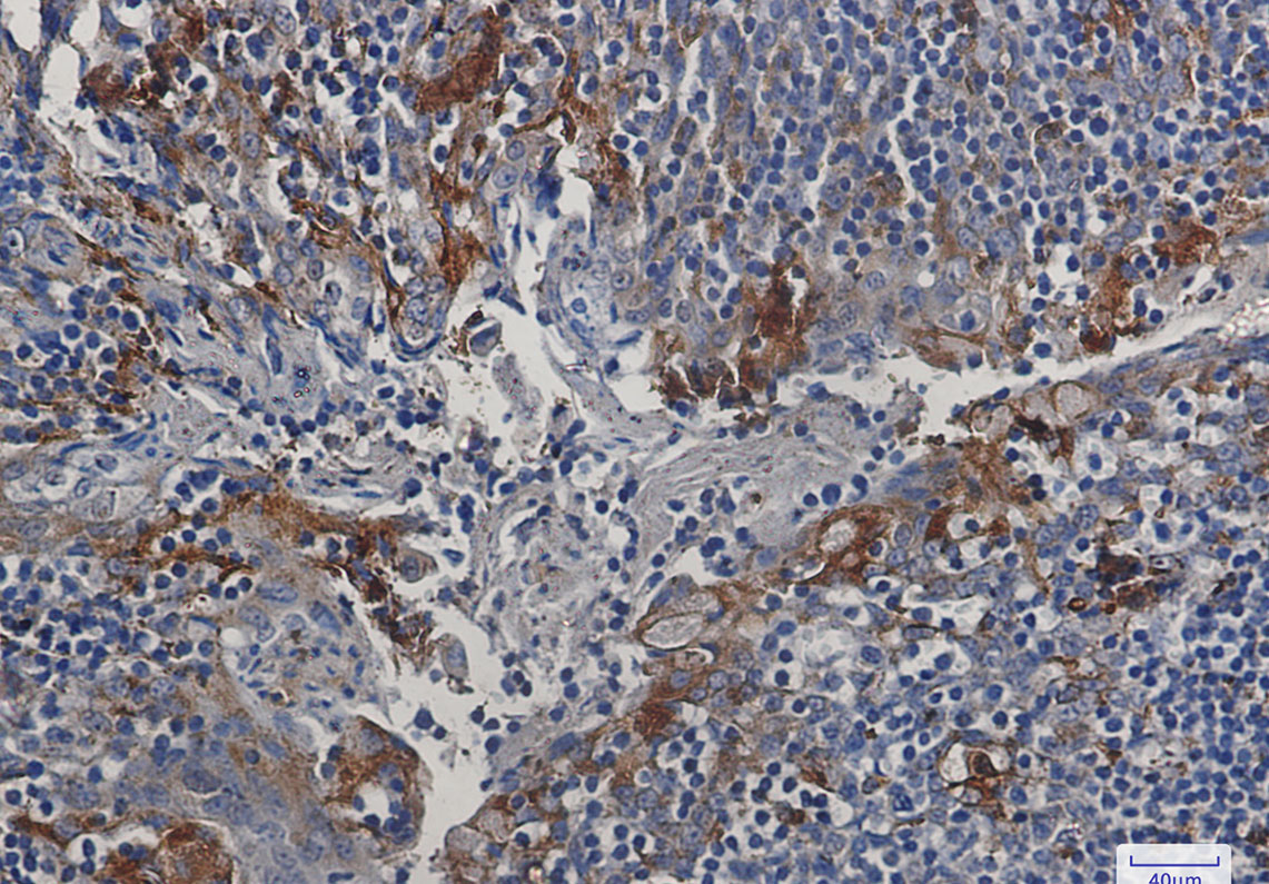 Cystatin C Rabbit mAb ABZ2702
