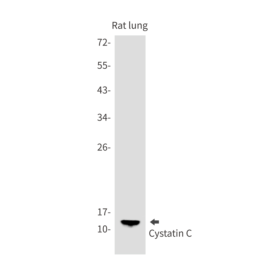 Cystatin C Rabbit mAb ABZ2702