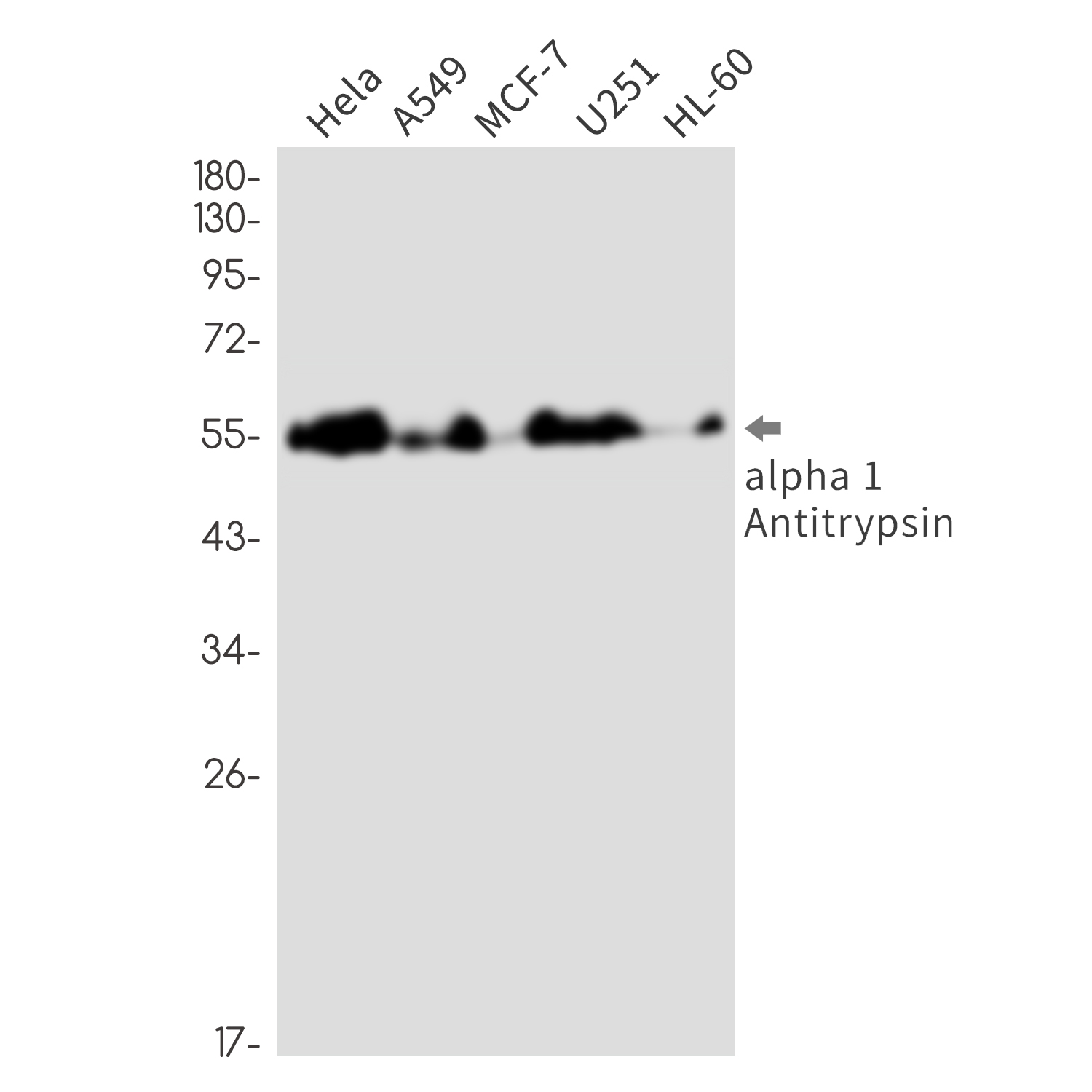 alpha 1 Antitrypsin Rabbit mAb ABZ2705
