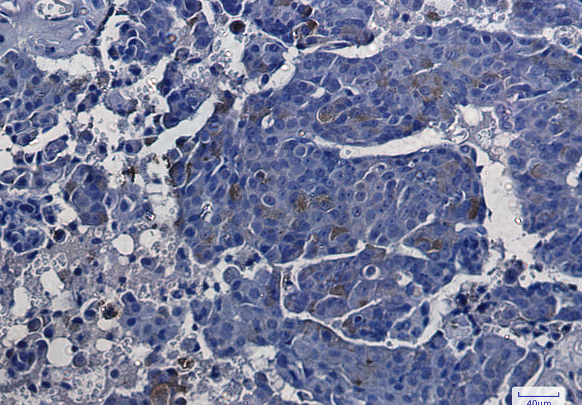 ASS1 Rabbit mAb ABZ2707