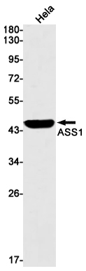 ASS1 Rabbit mAb ABZ2707