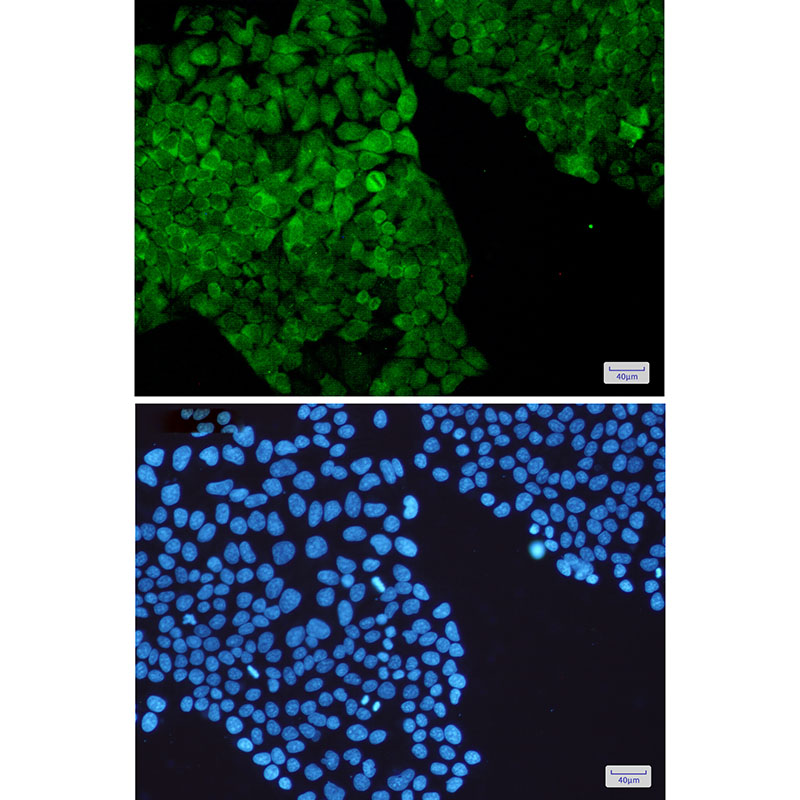 PGK1 Rabbit mAb ABZ2708