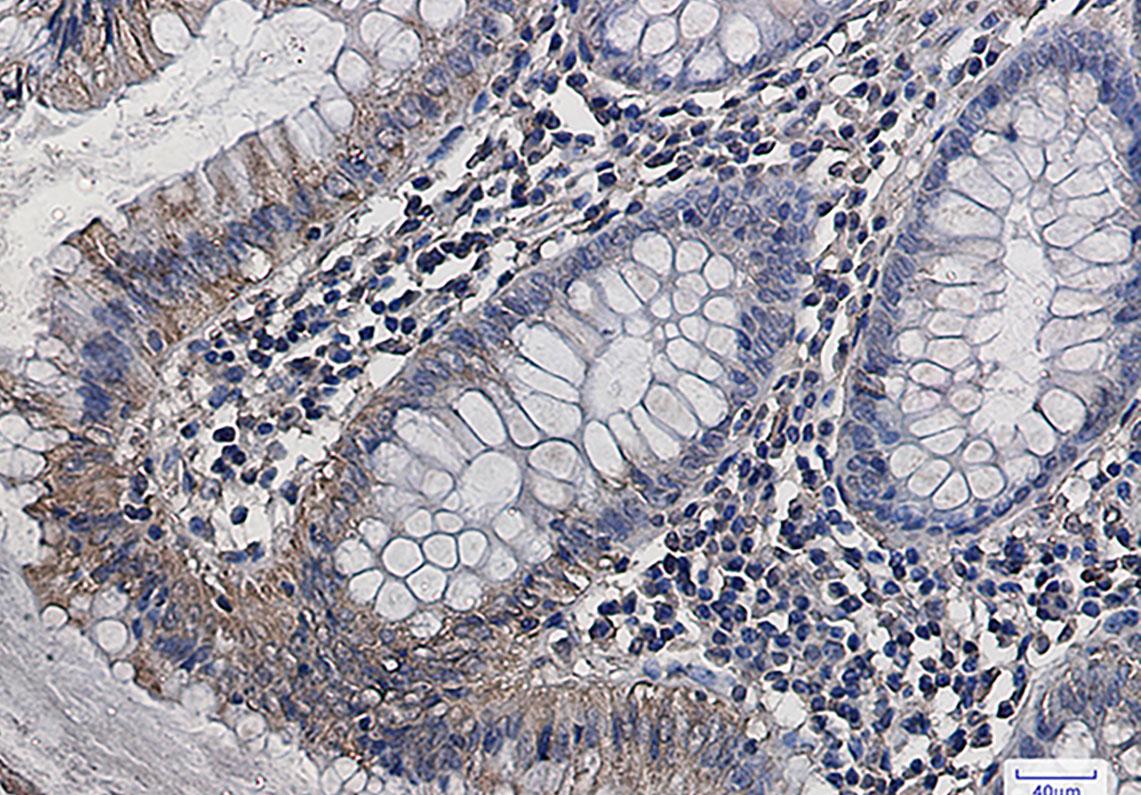 Aspartate Aminotransferase Rabbit mAb ABZ2709