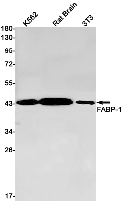 Aspartate Aminotransferase Rabbit mAb ABZ2709
