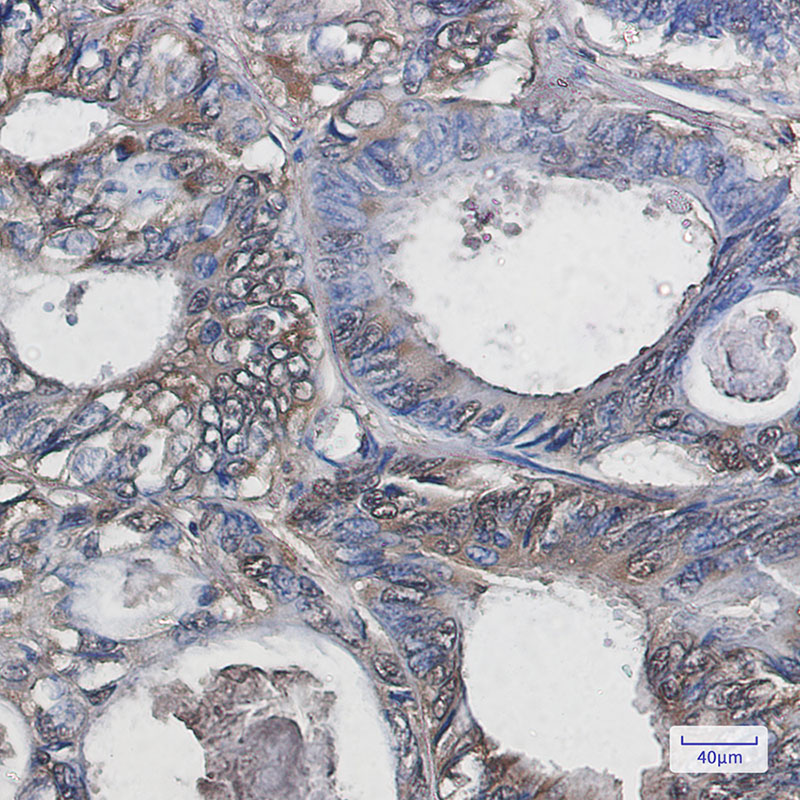 Superoxide Dismutase 1 Rabbit mAb ABZ2711