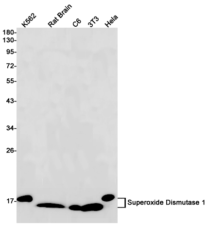 Superoxide Dismutase 1 Rabbit mAb ABZ2711