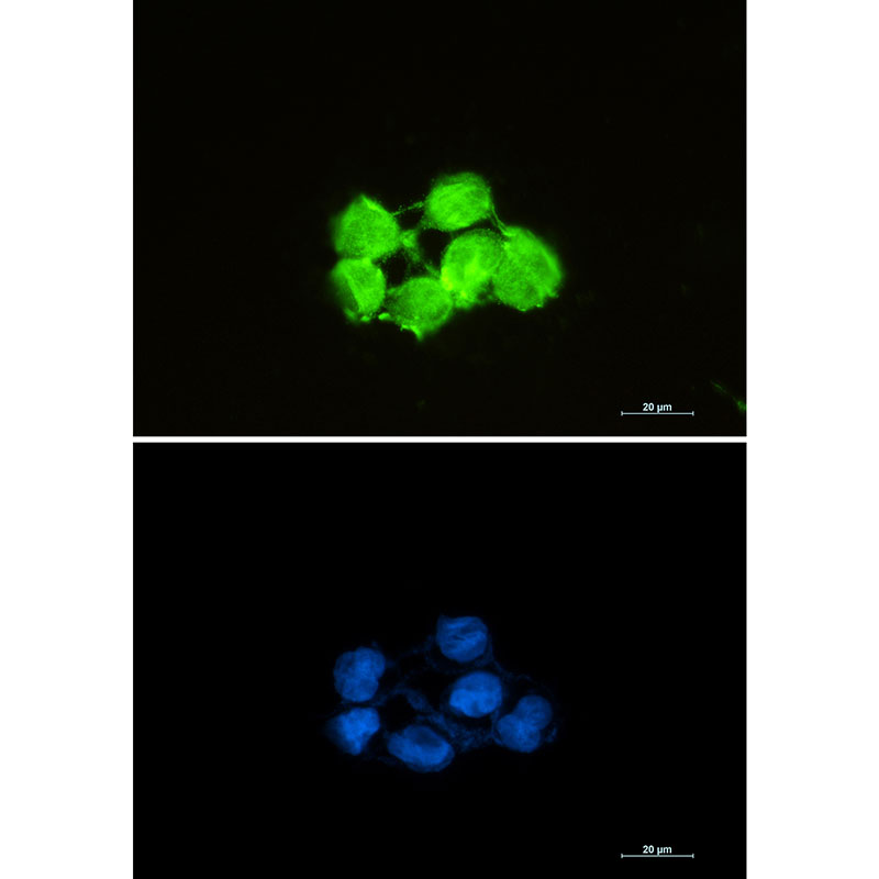 Superoxide Dismutase 1 Rabbit mAb ABZ2712