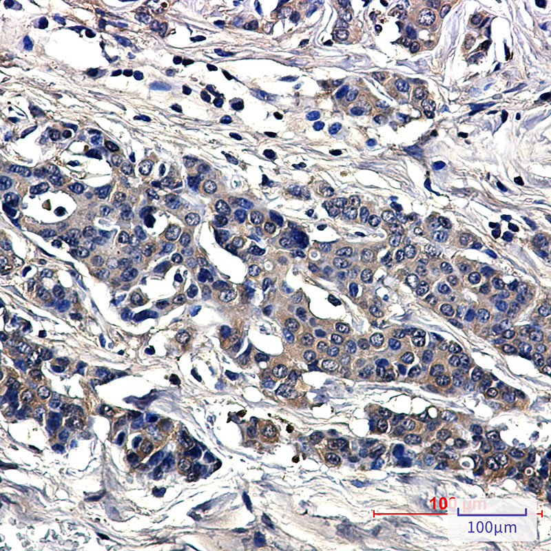 Superoxide Dismutase 1 Rabbit mAb ABZ2712